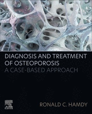 Diagnosis and Treatment of Osteoporosis 1