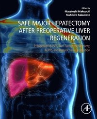 bokomslag Safe Major Hepatectomy after Preoperative Liver Regeneration