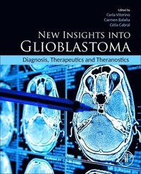 bokomslag New Insights into Glioblastoma