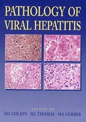 bokomslag Pathology of Viral Hepatitis