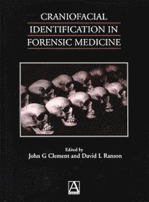 Craniofacial Identification in Forensic Medicine 1