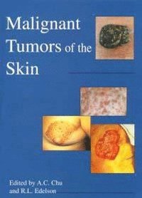 bokomslag Malignant Tumors of the Skin