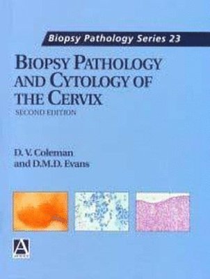 Biopsy Pathology and Cytology of the Cervix 1