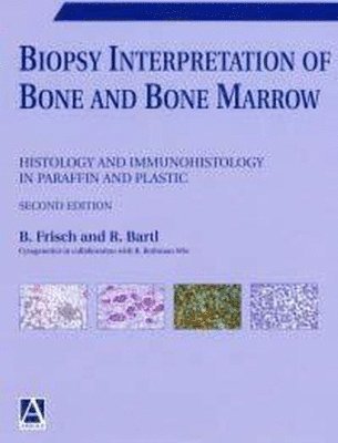 bokomslag Biopsy Interpretation of Bone and Bone Marrow