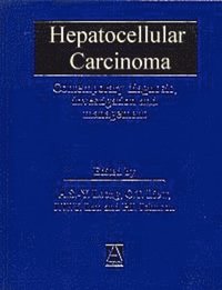 bokomslag Hepatocellular Carcinoma: Diagnosis, Investigation and Management