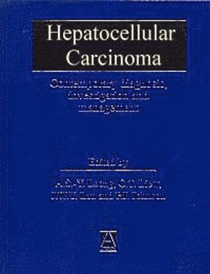 Hepatocellular Carcinoma: Diagnosis, Investigation and Management 1