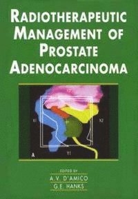bokomslag Radiotherapeutic Management of Prostate Adenocarcinoma