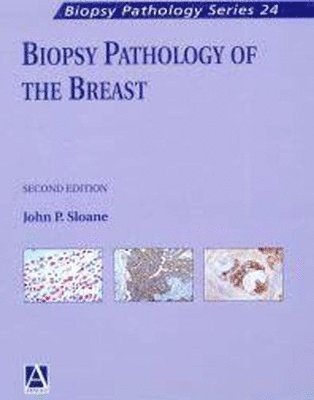 Biopsy Pathology of the Breast 1