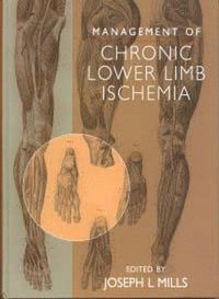 bokomslag Management of Chronic Lower Limb Ischemia