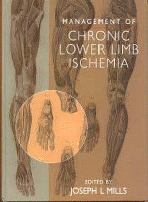 bokomslag Management of Chronic Lower Limb Ischemia