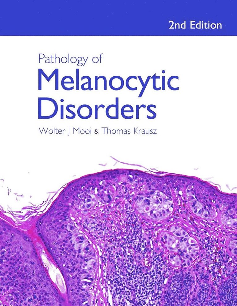 Walter Mooi, Thomas Krausz, USA) Krausz, Thomas (Professor of Pathology and Director of Anatomic Pathology, University of Chicago - Pathology of Melanocytic Disorders 2ed, Inbunden