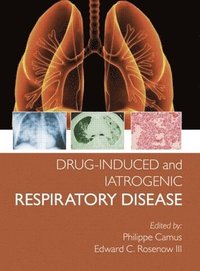bokomslag Drug-induced and Iatrogenic Respiratory Disease