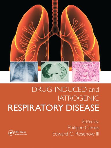 bokomslag Drug-induced and Iatrogenic Respiratory Disease