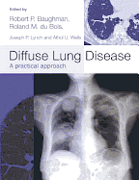 bokomslag Diffuse Lung Disease
