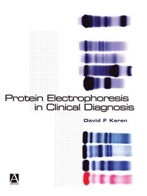 Protein Electrophoresis in Clinical Diagnosis 1