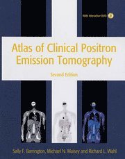 bokomslag Atlas of Clinical Positron Emission Tomography