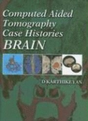 bokomslag Computed Aided Tomography Case Histories Of The Brain