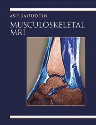 Musculoskeletal MRI: A Rapid Reference Guide