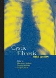 bokomslag Cystic Fibrosis