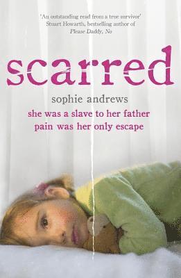 Scarred 1