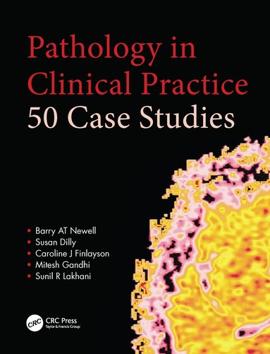 Barry AT Newell, Susan Dilly, Caroline Finlayson, Mitesh Gandhi, Sunil Lakhani - Pathology in Clinical Practice: 50 Case Studies, Häftad