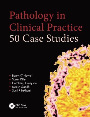 Pathology in Clinical Practice: 50 Case Studies 1