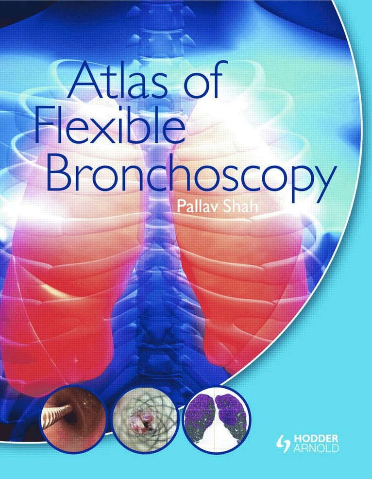 Pallav Shah - Atlas of Flexible Bronchoscopy, Inbunden