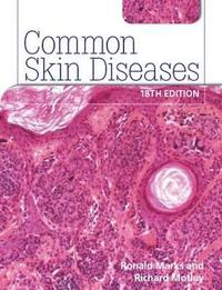 bokomslag Common Skin Diseases 18th edition