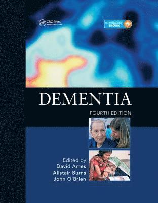 David Ames, Alistair Burns - Dementia, Inbunden