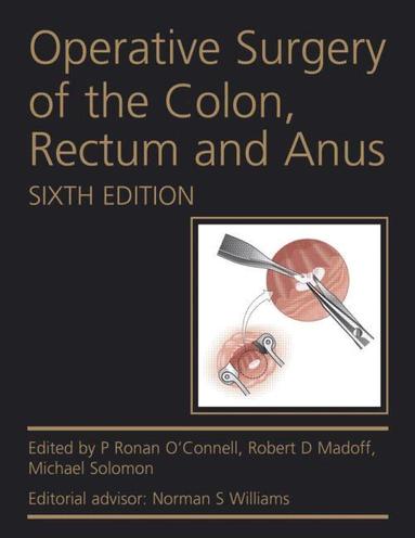 P Ronan O'Connell, Robert D. Madoff, Michael Solomon - Operative Surgery of the Colon, Rectum and Anus, Inbunden