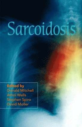 Sarcoidosis 1