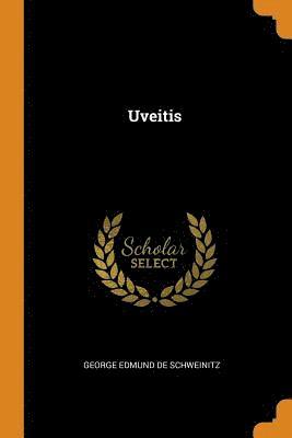 George Edmund De Schweinitz - Uveitis, Häftad. Tillgänglighet: Lägg i varukorg