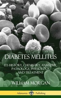 bokomslag Diabetes Mellitus: Its History, Chemistry, Anatomy, Pathology, Physiology, and Treatment (Hardcover)