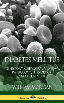 Diabetes Mellitus: Its History, Chemistry, Anatomy, Pathology, Physiology, and Treatment (Hardcover) 1