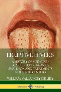 bokomslag Eruptive Fevers: A History of Medicine - Scarlet Fever, Measles, Small-Pox and Treatments in the 19th Century
