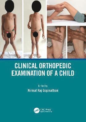 Nirmal Raj Gopinathan - Clinical Orthopedic Examination of a Child, Häftad