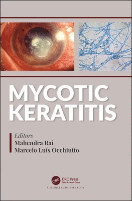 bokomslag Mycotic Keratitis