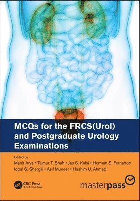 MCQs for the FRCS(Urol) and Postgraduate Urology Examinations 1