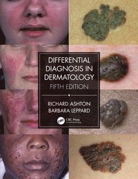 bokomslag Differential Diagnosis in Dermatology