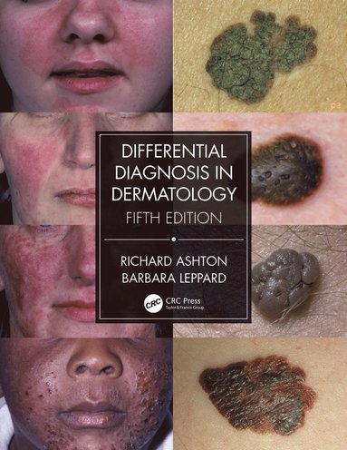 bokomslag Differential Diagnosis in Dermatology