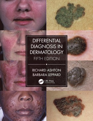 Differential Diagnosis in Dermatology 1