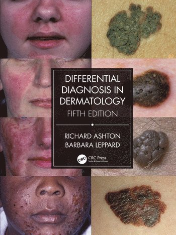 bokomslag Differential Diagnosis in Dermatology