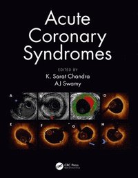 bokomslag Acute Coronary Syndromes
