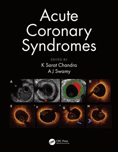 bokomslag Acute Coronary Syndromes