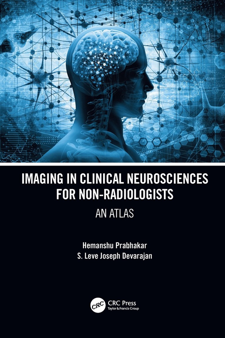 Hemanshu Prabhakar, S. Leve Joseph Devarajan, India.) Prabhakar, Hemanshu (AIIIMS, New Delhi, India) Devarajan, S. Leve Joseph (AIIMS, New Delhi - Imaging in Clinical Neurosciences for Non-radiologists, Inbunden