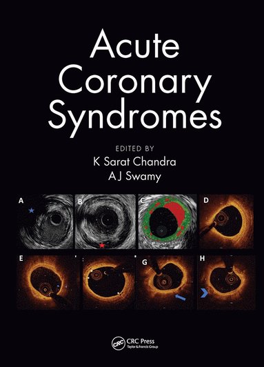 bokomslag Acute Coronary Syndromes