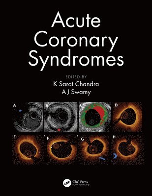 Acute Coronary Syndromes 1