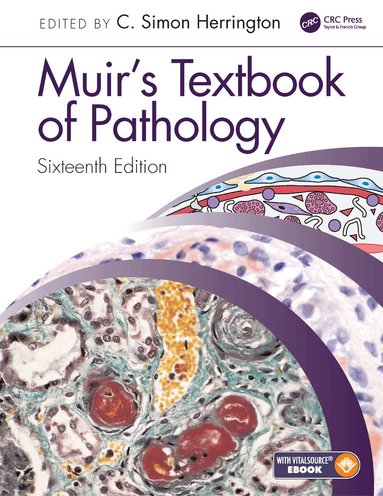 C Simon Herrington - Muir's Textbook of Pathology, Häftad