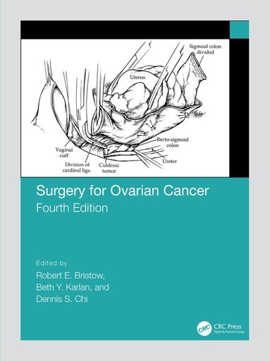 Robert Bristow, Beth Karlan, Dennis Chi - Surgery for Ovarian Cancer, Inbunden