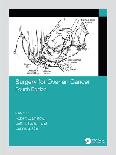 bokomslag Surgery for Ovarian Cancer